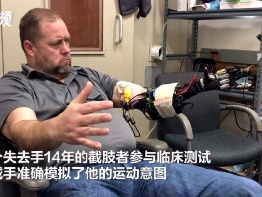 残疾人智能手(残疾人智能手臂)-图3 残疾人智能手(残疾人智能手臂)-图3