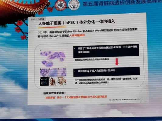 芯片腎脏在中国（中国芯片人工肾）