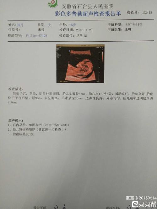 nt值与芯片检查（芯片nto）