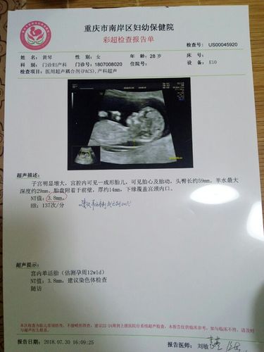 nt值与芯片检查(芯片nto)-图3 nt值与芯片检查(芯片nto)-图3