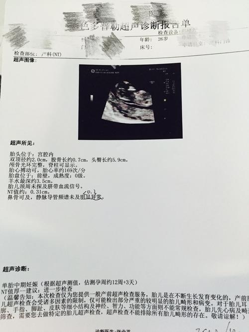 nt值与芯片检查(芯片nto)-图2 nt值与芯片检查(芯片nto)-图2